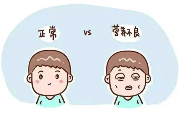 脂肪肝,轻度脂肪肝