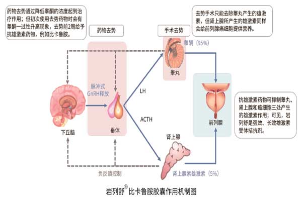 前线腺癌,sunbet,比卡鲁胺胶囊